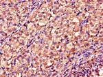 DDAH2 Antibody in Immunohistochemistry (Paraffin) (IHC (P))