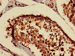 B4GALT3 Antibody in Immunohistochemistry (Paraffin) (IHC (P))