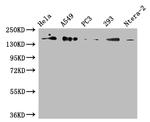 DUOX2 Antibody in Western Blot (WB)