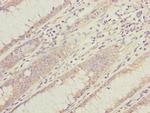 DYNC1I1 Antibody in Immunohistochemistry (Paraffin) (IHC (P))