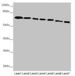 DYNC1I1 Antibody in Western Blot (WB)