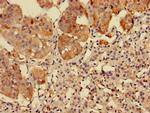 RPS5 Antibody in Immunohistochemistry (Paraffin) (IHC (P))