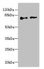 ECD Antibody in Western Blot (WB)