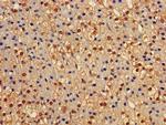 EPHX2 Antibody in Immunohistochemistry (Paraffin) (IHC (P))