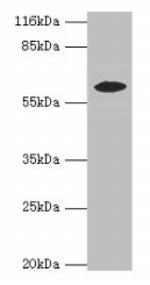 EPHX2 Antibody in Western Blot (WB)