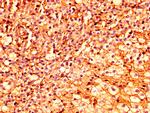 ESRP2 Antibody in Immunohistochemistry (Paraffin) (IHC (P))