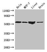 ETS2 Antibody in Western Blot (WB)