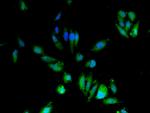 CDA Antibody in Immunocytochemistry (ICC/IF)