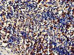 CDA Antibody in Immunohistochemistry (Paraffin) (IHC (P))