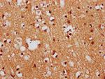 FEZF1 Antibody in Immunohistochemistry (Paraffin) (IHC (P))