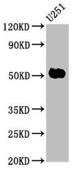 FEZF1 Antibody in Western Blot (WB)