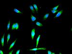 FGFR1 Antibody in Immunocytochemistry (ICC/IF)