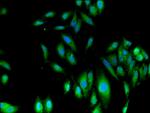 Fumarase Antibody in Immunocytochemistry (ICC/IF)