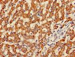 Fumarase Antibody in Immunohistochemistry (Paraffin) (IHC (P))