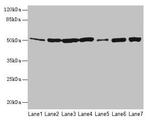 Fumarase Antibody in Western Blot (WB)