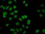 FLI1 Antibody in Immunocytochemistry (ICC/IF)