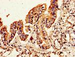 FLI1 Antibody in Immunohistochemistry (Paraffin) (IHC (P))