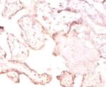 FTSJ1 Antibody in Immunohistochemistry (Paraffin) (IHC (P))