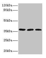 FTSJ1 Antibody in Western Blot (WB)