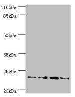 FXN Antibody in Western Blot (WB)