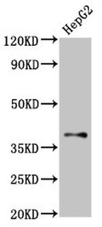 GALR1 Antibody in Western Blot (WB)