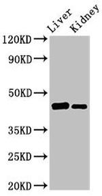 GALT Antibody in Western Blot (WB)