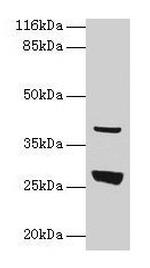 GAMT Antibody in Western Blot (WB)