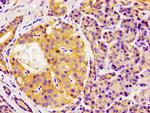 GAS1 Antibody in Immunohistochemistry (Paraffin) (IHC (P))