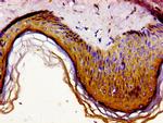 GAS1 Antibody in Immunohistochemistry (Paraffin) (IHC (P))