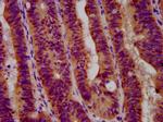 GBA Antibody in Immunohistochemistry (Paraffin) (IHC (P))