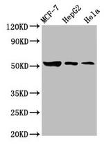 GBA Antibody in Western Blot (WB)