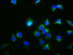 GDF5 Antibody in Immunocytochemistry (ICC/IF)