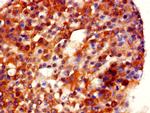 GDI2 Antibody in Immunohistochemistry (Paraffin) (IHC (P))