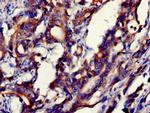 GDI2 Antibody in Immunohistochemistry (Paraffin) (IHC (P))