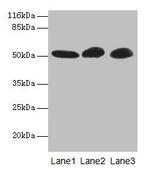 GDI2 Antibody in Western Blot (WB)