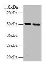 GDI2 Antibody in Western Blot (WB)