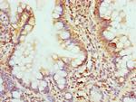 GMPS Antibody in Immunohistochemistry (Paraffin) (IHC (P))