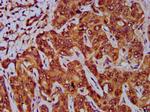 GNA12 Antibody in Immunohistochemistry (Paraffin) (IHC (P))