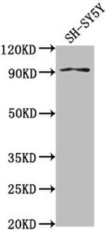 GPLD1 Antibody in Western Blot (WB)