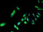 PP2A beta Antibody in Immunocytochemistry (ICC/IF)