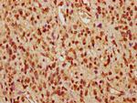 PP2A beta Antibody in Immunohistochemistry (Paraffin) (IHC (P))