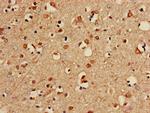 PP2A beta Antibody in Immunohistochemistry (Paraffin) (IHC (P))