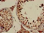 GRK4 Antibody in Immunohistochemistry (Paraffin) (IHC (P))