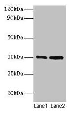 GTF2B Antibody in Western Blot (WB)