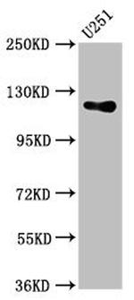 PGCD Antibody in Western Blot (WB)