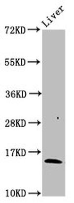 HBB Antibody in Western Blot (WB)