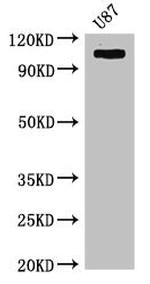 HK2 Antibody in Western Blot (WB)