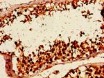 HLTF Antibody in Immunohistochemistry (Paraffin) (IHC (P))