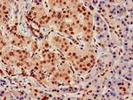 hnRNP A1 Antibody in Immunohistochemistry (Paraffin) (IHC (P))