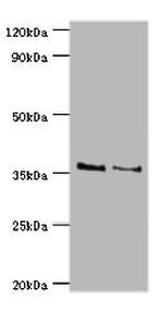 HOXA1 Antibody in Western Blot (WB)